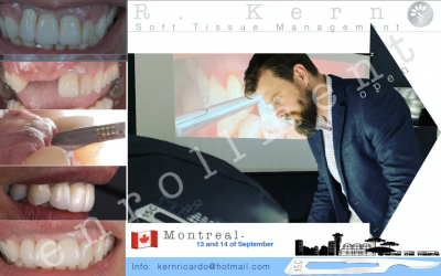 SOFT TISSUE GRAFT AND PERI-IMPLANT SOFT TISSUE MANAGEMENT